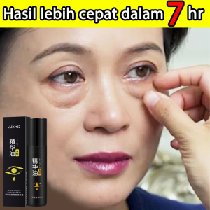 Penghilang Kantung Mata EYE BAG SERUM Kulit Anti-krim kantung mata ampuh-menghilangkan mata panda-Bengkak Lingkaran Hitam Anti-serum penghilang kantong mata ori- serum mata panda dan keriput-obat kantung mata paling ampuh - Lazada