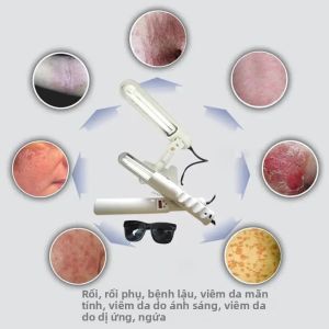 Đèn Trị Liệu Bằng Tia Cực Tím 311NM UVB Cho Bệnh Bạch Biến Bệnh Vẩy Nến Điều Trị Bệnh Chàm Thiết Bị Trị Liệu Bằng Ánh Sáng Cực Tím