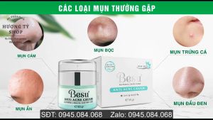 Kem Sạch Besu Cao Cấp Làm Sạch Mụn Thâm Và Dưỡng Trắng Da Tự Nhiên