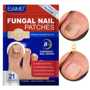 Grey toed nail fungus patch hydrogel improves infection fixation anti abscission and promotes new nail growth
