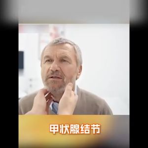 Obat Gondok Kelenjar Tiroid Hipertiroid Hipotiroid Gondok Beracun 35g Kista Tiroid Gondong Benjolan Di-Leher Herbal alami tidak memiliki efek samping