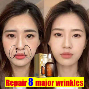 Hexapeptide anti wrinkle serum for face serum for Anti aging serum and wrinkle Melasma And Pekas Remover Hyaluronic Acid Face Serum Retinol Serum Anti Wrinkles Dark Spots Remover Blemishes Serum for Firming Skin Moisturizer Brighten 50ml