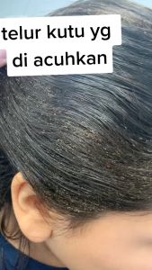 [Bisa COD] Distributor Heekea Sampo Anti Kutu Menghilangkan Kutu Dan Menyehatkan Rambut mengandung zat aktif ekstrak Citrus Lemonium dan Allium Cepa Alami