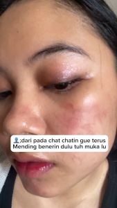 CHALONESE TRUE BEAUTY SET (1 PCS FACIAL WASH+ 1 PCS SUNSCREEN + 1 SET MOISTURIZER)