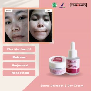 Yonglow Skincare Paket 2in1 Serum Darkspot Day Cream Krim Siang Resmi BPOM Formulasi dr Yong Serum Penghilang Flek Melasma Membandel Serum Penghilang Noda Hitam Pemutih Kulit Wajah Glowing