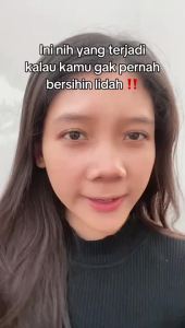 QoraL SOFT pembersih lidah / sikat lidah / tongue cleaner