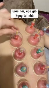 Bộ Giác Hơi Không Dùng Lửa 24 Cốc Chính Hãng