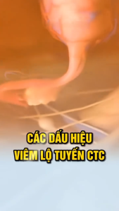 1 VIÊN LẼ TIÊU VIÊM NỮ BÁCH BÌNH VIÊM