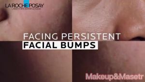 La Roche-Posay Pure Vitamin C10 Face Serum with Hyaluronic Acid Salicylic Acid Face Essence 30ML