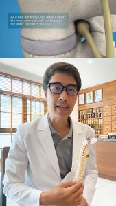 Nước uống Khang Cốt Thủy - Thoát Vị Đĩa Đệm Thoái Hóa Cột Sống