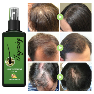 Hot ready stock hair growth spray ginge hair tonic scalp anti hair loss hair care penumbuh rambut cepat original pelebat rambut120ml防脱育发生发液