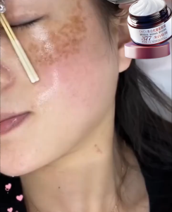 377 Facial Moisturizers Freckle Cream Whitening Moisturizing Melasma Remover Melasma Cream Brighten Skin Cream 30g