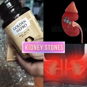 [NEW] Golden Nepro – 30 Capsules | Kidney & Gallstone Support | Natural Relief for Stone Problems
