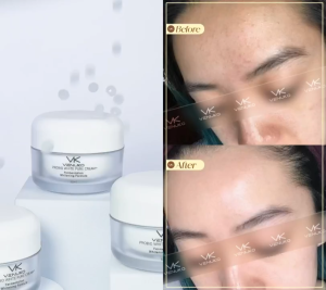 KEM DƯỠNG SÁNG DA VENUKO PROBIO WHITE PURE CREAM 50ML