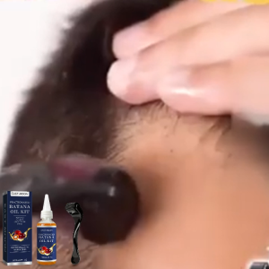 East Moon Batana Oil Kit Batana Hair Care Essential Oil Natural Organic Batana Oil Anti Hair Loss Essential  Serum High Quality Ingredients 60ml+ 1roller / box