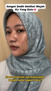 CHALONESE Paket Skincare BPOM 9 in 1 + 8 IN 1Paket Glowing BPOM Paket Skincare Cream Whitening Moisturizer Sunscreen SPF50+++ Facial Wash Skin Care Wajah COD