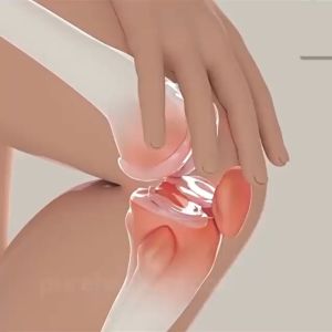 PERFECTX INTENSIVE JOINT and BONE THERAPY Osteoarthritis Cream - 30g Pain Cream