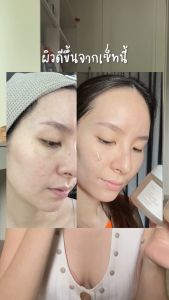 [MISSYKIM]Dr.ceuracle Vegan Kombucha Tea Beginning Set (วีแกนคอมบูชะที บิกินนิ่ง เซ็ท) Kombucha Tea Essence 50ml. + Kombucha Tea Gel Cream 30g.