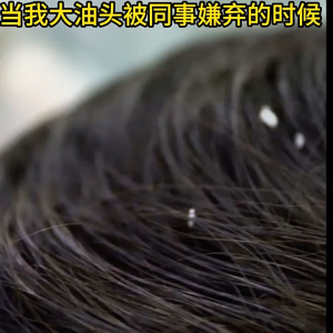 抖音爆款~~侧柏叶乌斯曼养发皂💚💚(100g) Arborvitae & Usman Grass Herbal Hair Soap