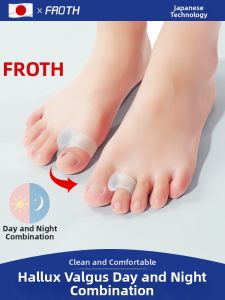 FROTH | Thumb External Rotation Bunion Corrector Separation Corrector Wearable Shoe Toe Separator