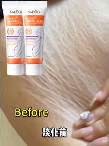 【BUY 1 TAKE 1】Original Anti Stretch Mark Cream Scar Remover Anti-Wrinkle Maternity Skin Repair Remove Pregnancy Scars Wrinkle Natural Pregnancy Moisturizer repair All Skin Types