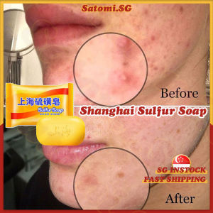 💄SG stock💄 Shanghai sulfur soap / Sulphur soap / Acne soap bar / Anti fungal soap / Antibacterial eczema soap / 上海硫磺皂 / 硫磺肥皂