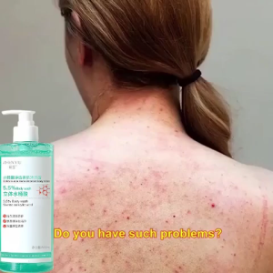 Acne body wash eczema body wash sabun badan Antibacterial body wash whitening shower gel 500ML Anti mite 蟎蟲 沐浴露
