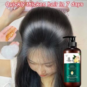 Shampoo kelemumur Anti Dandruff Shampoo kelemumur Treatment hilangkan kelemumur Oil Control Anti Hair Lost Moist Shine Natural Ginger Anti-Hair Loss Shampoo 500ml Oil Control Anti-Dandruff Anti-Itch Nourishing Shampoo Hair Loss Treatment
