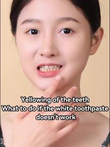 ✨ 2025 ✨ Teeth Whitening Dental Instrument Blue Light Ultrasonic Electric Toothbrush Charging Automatic Timing Teeth Cleaner