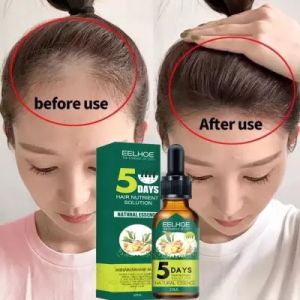 EELHOE Hair Growth Serum PENUMBUH RAMBUT Clothes of Skin 5 Days Ginger Germinal Oil Minyak Penumbuh Dan Perawatan Rambut 30ML