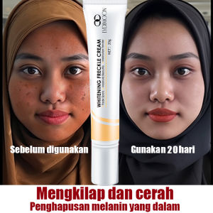 flek hitam membandel di wajah salep cream penghilang flek hitam cream penghilang flek tebal niacinamide melembabkan kulit