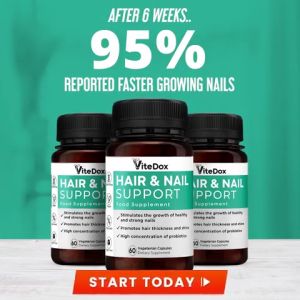 ViteDox Hair & Nail Support Food Supplement