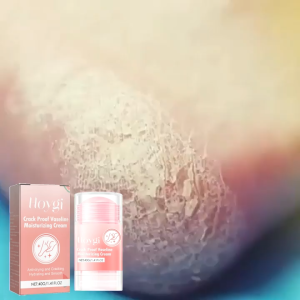 Hoygi Foot Care Cream Exfoliating Dead Skin Softening Smooth Moisturizing Foot Cream 40g