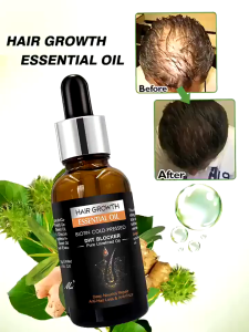 Tinh Dầu Mọc Tóc Biotin DHT Blocker – Ngăn Rụng Kích Thích Mọc Tóc Giảm Gàu Giúp Tóc Dày Khỏe