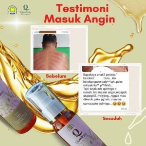 bisa cod| quwles qulmigo | minyak pijit| minyak urut| obati keseleo| qulmigo message oil