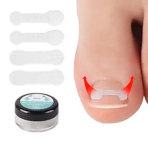 10Pcs Ingrown Toenail Correction Tool/Korektor Kuku Cantengan/Gunting Cantengan/Paronychia Treatment/Toe Nail Treatment Elastic Patch Toenail Correction Sticker Korektor Kuku Kaki