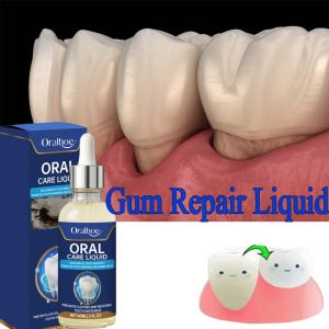 OUHOE | 60ML Damaged Gum RepairCare Gel Serum Relieve Sore Gums Allergy Deep Cleaning Teeth Stains Tartar Serum Dental Caries Toothpaste