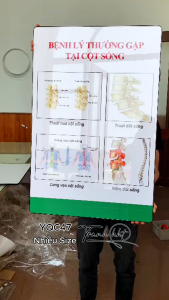 Tranh phòng khám y khoa tranh y tế tranh cơ xương khớp Tranh Y khoa bệnh lý hay gặp ở cột sống tráng gương treo tường YQC47