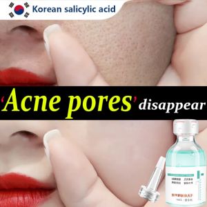 【Hot in Korea】100% original pore minimizer serum 32ml 7 day pores disappear hyaluronic acid relieve dryness moisturizing dewy skin pore shrinking serum firming moisturizing oil control repairing smooth skin care effective shrink pores