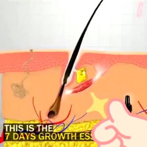 Minoxidil 5% Extra Strength Penumbuh Rambut 100% ORIGINAL Beard Oil Serum Penumbuh Dan Penebal Cepat Rambut Brewok Kumis Jambang 30ml Serum Penumbuh Rambut Cepat Penumbuh rambut Pengontrol Minyak Anti rambut rontok Anti ketombe