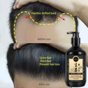 Shampoo Anti Ketombe & Rambut Rontok: Shampo Jahe 300ml