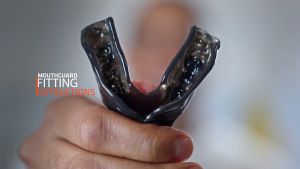 Shock Doctor EZ-Gard ฟันยางรุ่นเบสิค |Official Shop| ฟันยางนักมวย บาส นักกีฬา mouthguard mouth guard