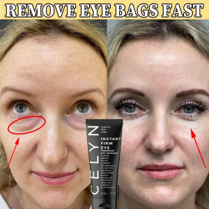 Celyn eye cream for wrinkles eyebag eyebags remover original eyebag remover for men eye cream for dark under eye eye puffiness remover temporary eye tightener elen ella eye cream serum pampatanggal ng eyebags 30ml