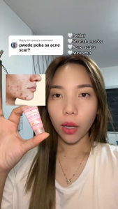 Best Seller ORGANIC SCARLESS MIRACLE CREAM SPF30 | Helps Improve the Appearance of Stretch Marks Dark Spots Freckles & Fine Lines | Effective Scar Remover for Old & New Scars | Intensive Brightening & Anti-Aging Cream with Niacinamide and Sunflower Oil