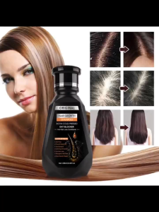 PEIMEI HAIR GROWTH SHAMPOO (250ML) SG SELLER *FAST DELIVERY* ANTI HAIR LOSS & HAIR CARE for All Hair Types EFFECTIVE HAIR LOSS SOLUTION (Ginger shampoo Ginger Anti Hair LossHair Growth ShampooFOR SCALP CAREAnti-Hair LossShampoo For Oily ScalpHERBAL