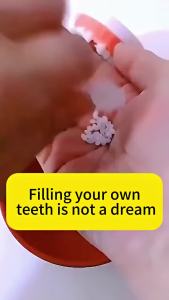 ​​Resin False Teeth Solid Glue Repair Teeth Gap Denture Adhesive Moldable Filling Broken Teeth​ Tool 30ML