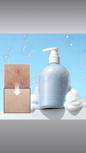 ione Creamy Relief Body Wash 400ml Acne Soothing Salicylic Acid Keratin Sebum Sensitive Skin