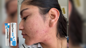 AMZ Facial Care Cream Fertilizes Facial Acne Soft Moisturizes Hydrates Refreshes Soft Smooth Skin Daily Care Cream