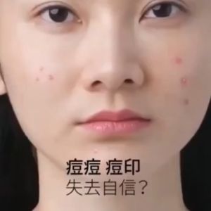 100% Effective Quickly Removes Pimples And Anti-Acne Treatment Cream Pimple Remover Acne Cream Gel Acne Scar Remover Skin Care Repair Acne Pits Facial Scar Care Shrink Pores Aloe Vera Acne Remover 25g