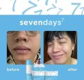 Seven days by her skin Rejuvenating set. 